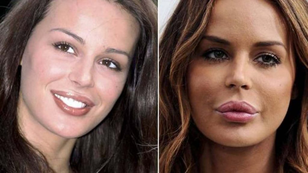 Prima E Dopo Chirurgia Estetica Belen Rodriguez e Nina Moric, le donne di Corona: prima e dopo la