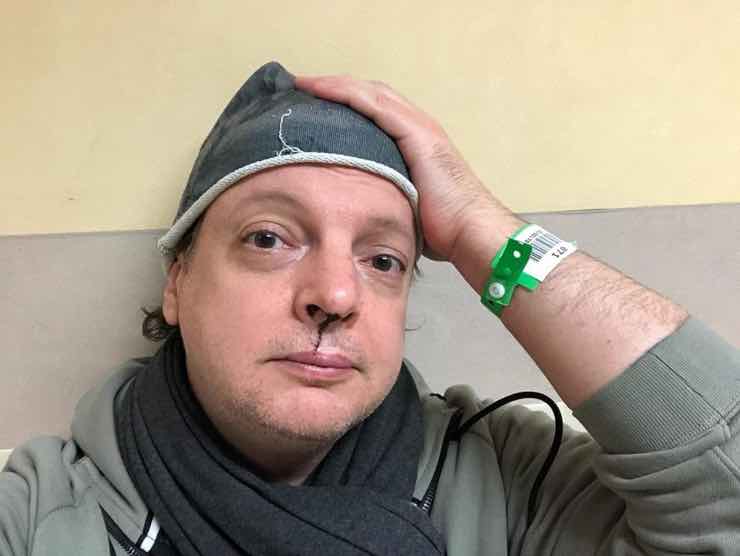 Dado al pronto soccorso dopo l'aggressione | Web Source