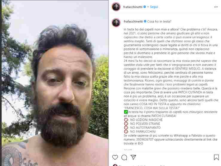 Il post Instagram dove Facchinetti racconta il suo problema | Instagram