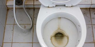 Eliminare macchie scure WC